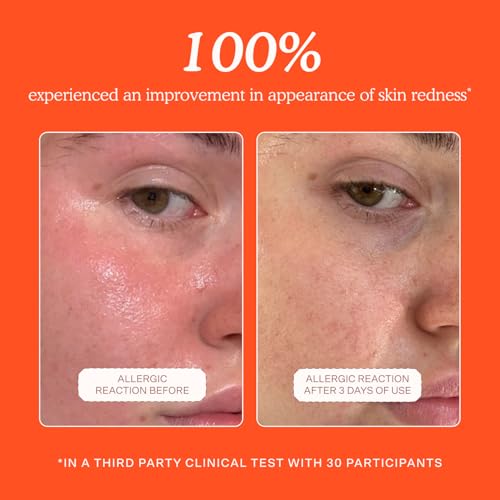 Tower 28 SOS Daily Rescue Facial Spray - Hypochlorous Acid Spray to Help Reduce Redness, Calm Irritation + Alleviate Flare-Ups - Purifying Travel Size Face Toner - Everyday Skin Care Essential (1 oz) - Image 3