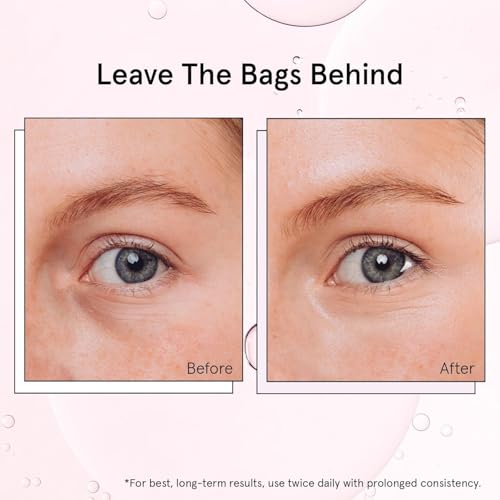 grace & stella Under Eye Brightener Roller - Airplane Travel Essentials - Travel Size Toiletries - Retinol & Caffeine Eye Serum for Puffiness, Dark Circles, Wrinkles - Vegan Skincare (15ml / 0.51floz) - Image 6