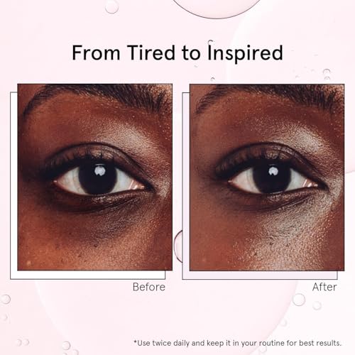 grace & stella Under Eye Brightener with Cooling Metal Rollerball - Centella Asiatica & Caffeine Eye Serum for Puffy Eyes - Travel Essentials - Under Eye Cream - Travel Essentials (15ml / 0.51floz) - Image 4