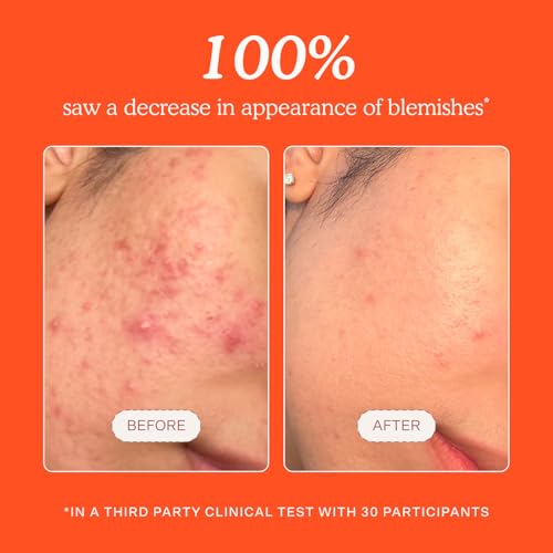 Tower 28 SOS Daily Rescue Facial Spray - Hypochlorous Acid Spray to Help Reduce Redness, Calm Irritation + Alleviate Flare-Ups - Purifying Travel Size Face Toner - Everyday Skin Care Essential (1 oz) - Image 4