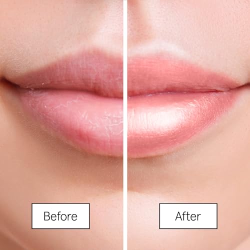 grace & stella Award Winning Lip Butter - Hydrating Lip Balm - Nourishing Lip Mask (1-pack) Travel Essentials, Travel Size Toiletries, Birthday Gifts for Women & Teens - Overnight Lip Repair - Vegan - Image 3