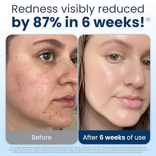 Clean Skin Club Clean Towels XL®, Travel Pack 100% USDA Biobased Disposable Face Towel, Eczema Association Accepted,Dry Wipes, TSA-Approved Travel Essential, 3 Packs, 30 ct Total - Image 2