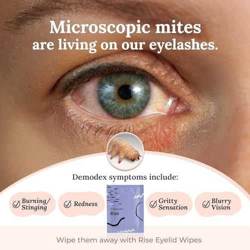 CorneaCare Rise: Eyelid Wipes | Eye Wipes for Dry Eyes | Eyelid Wipe with Tea Tree Oil & Hyaluronic Acid | Travel Ready | 30 Count - Image 3