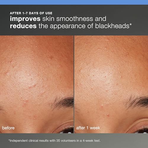 Dermalogica Discover Healthy Skin Kit - Includes: Precleanse, Face Wash, Face Exfoliator, & Moisturizer - Wash Away Impurities To Reveal Glowing Skin - Image 5